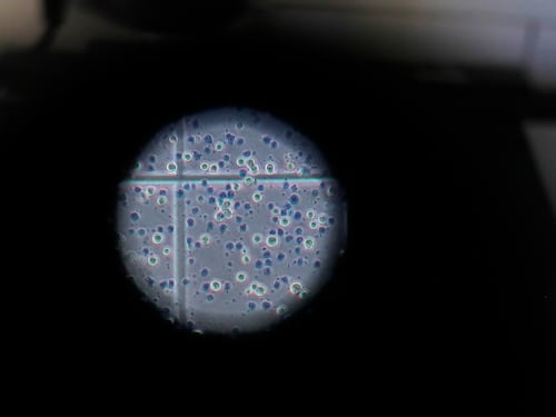 Qual è il "punto debole" dell'incubo Coronavirus