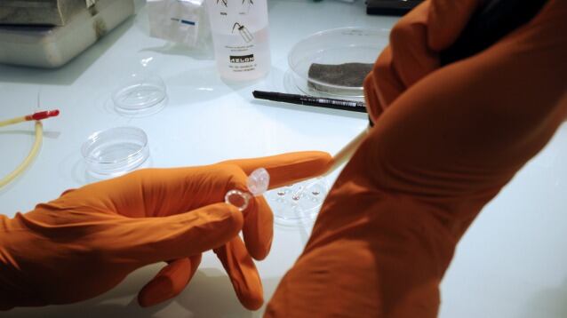 Cellule riprogrammate contro la leucemia, intervento al Bambin Gesù
