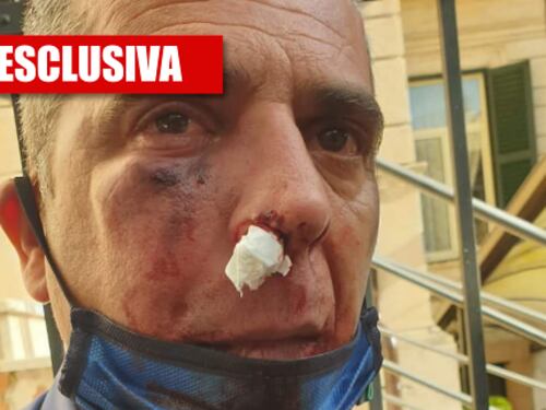 L'immigrato gli sferra due pugni e spacca la faccia al militare