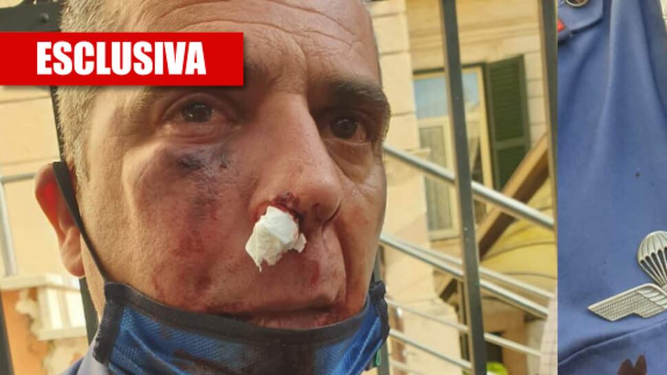 L'immigrato gli sferra due pugni e spacca la faccia al militare