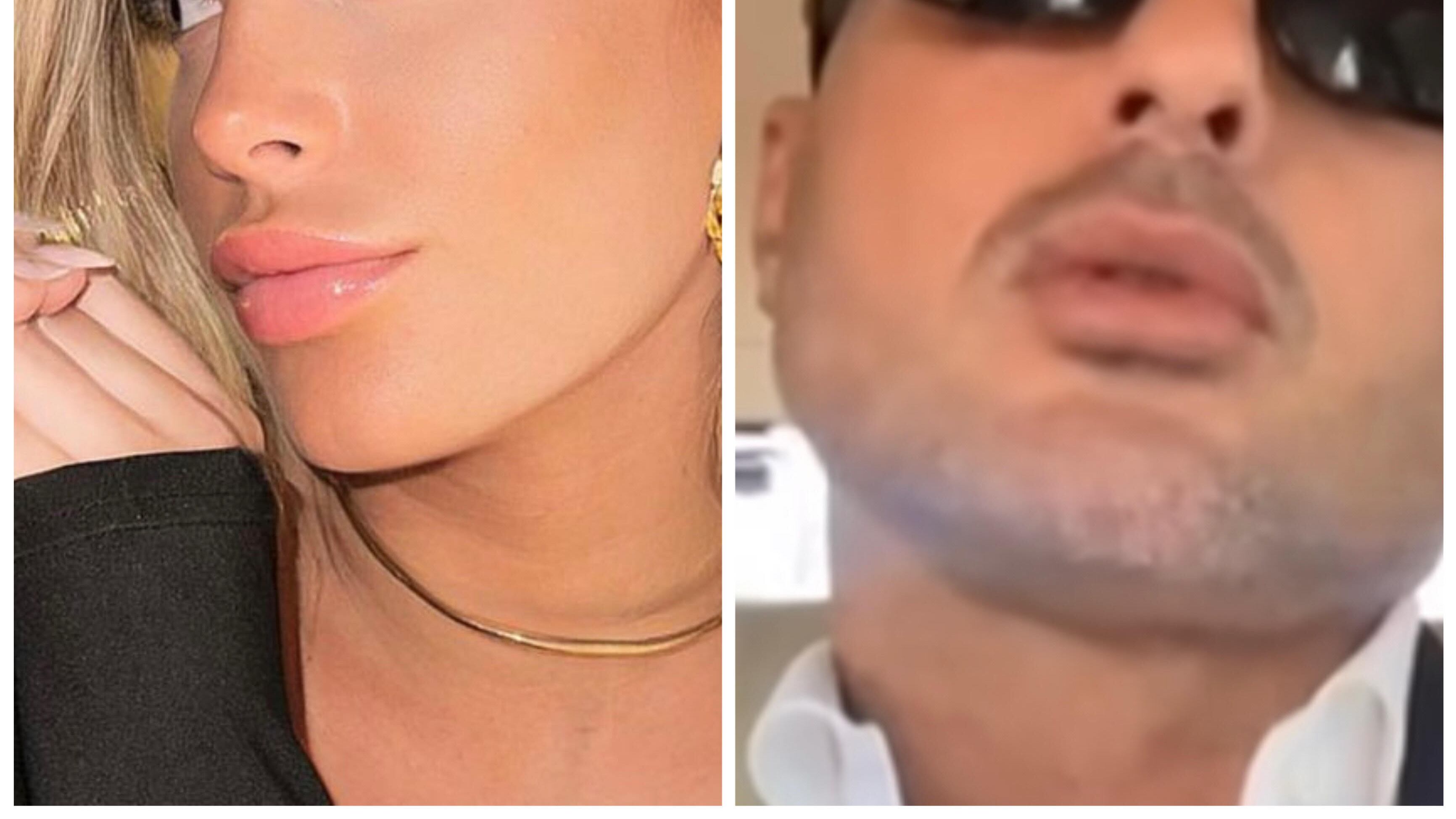 "Si è fatta il filler in gravidanza". Fabrizio Corona contro l'influencer