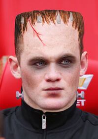 Rooney pubblica le foto del suo infortunio e sul web scatta la satira 3