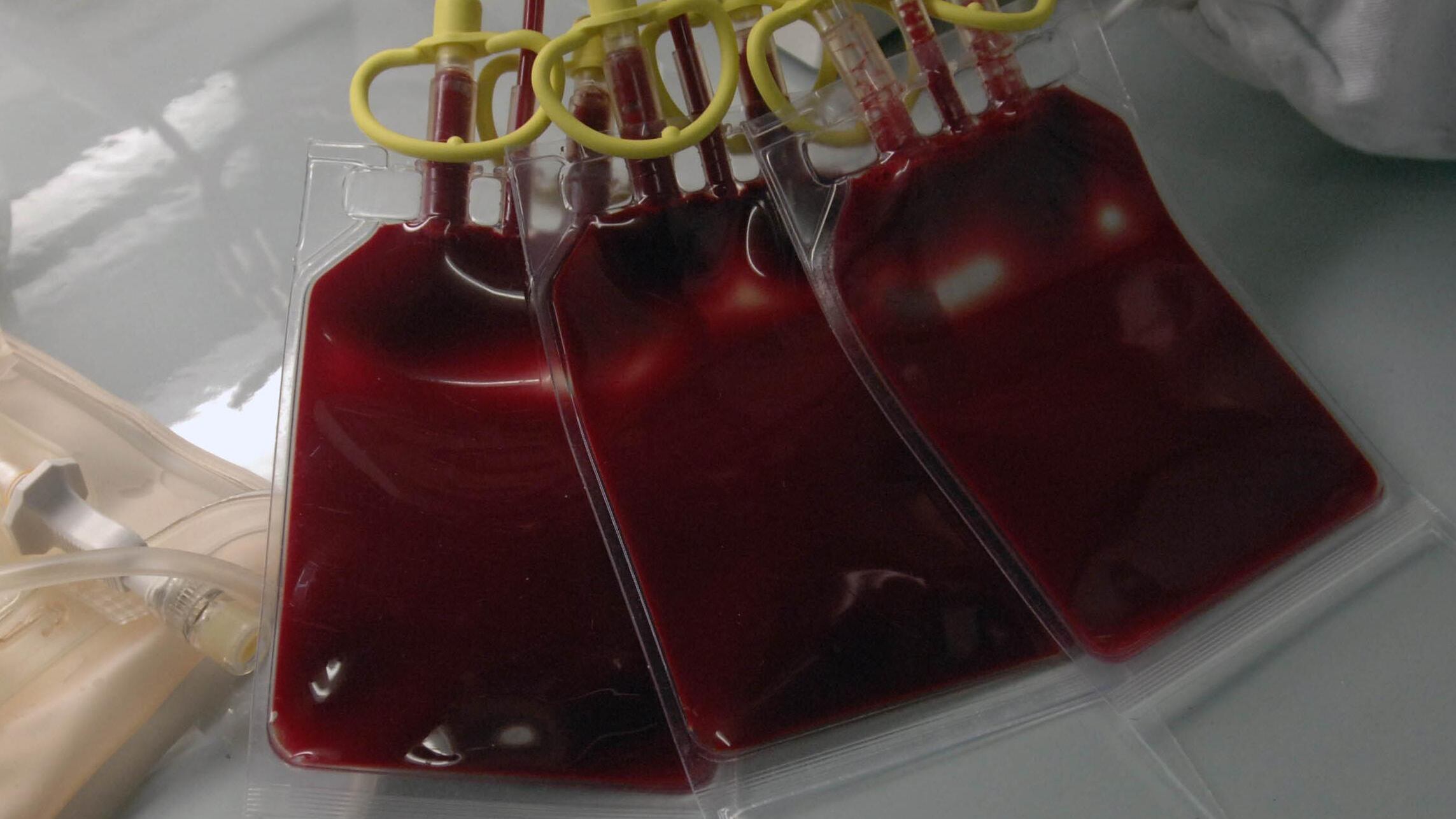 Prelievi di sangue inutili per gonfiare i rimborsi Perquisito il San Gerardo