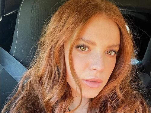 Trova l'auto sui ceppi. La rabbia di Ludovica Bizzaglia: "Questo succede a Roma"