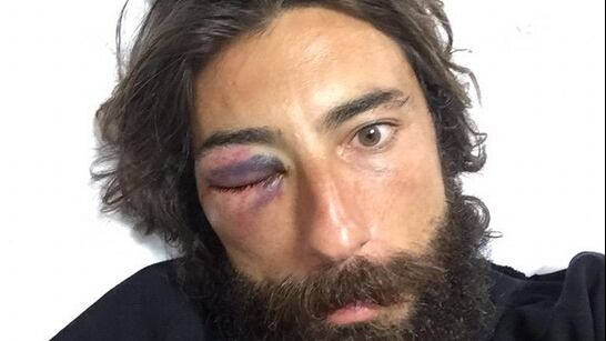 Striscia, Brumotti rivela: "Ho superato il confine"