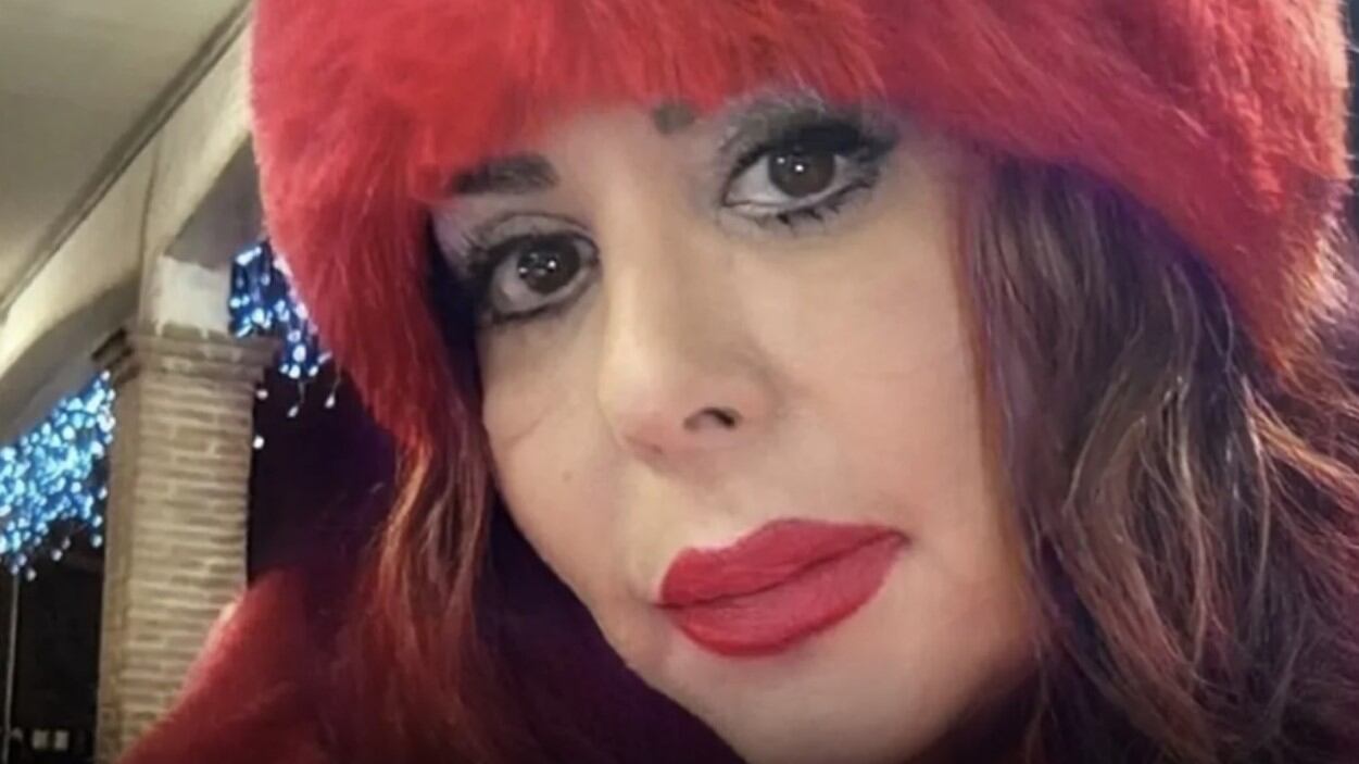 Donna muore per una liposuzione dopo una lunga agonia: "Infezioni ovunque", il chirurgo era recidivo