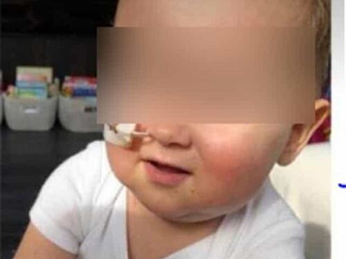 Alex sta bene. Il trapianto è riuscito e potrà uscire dall’ospedale
