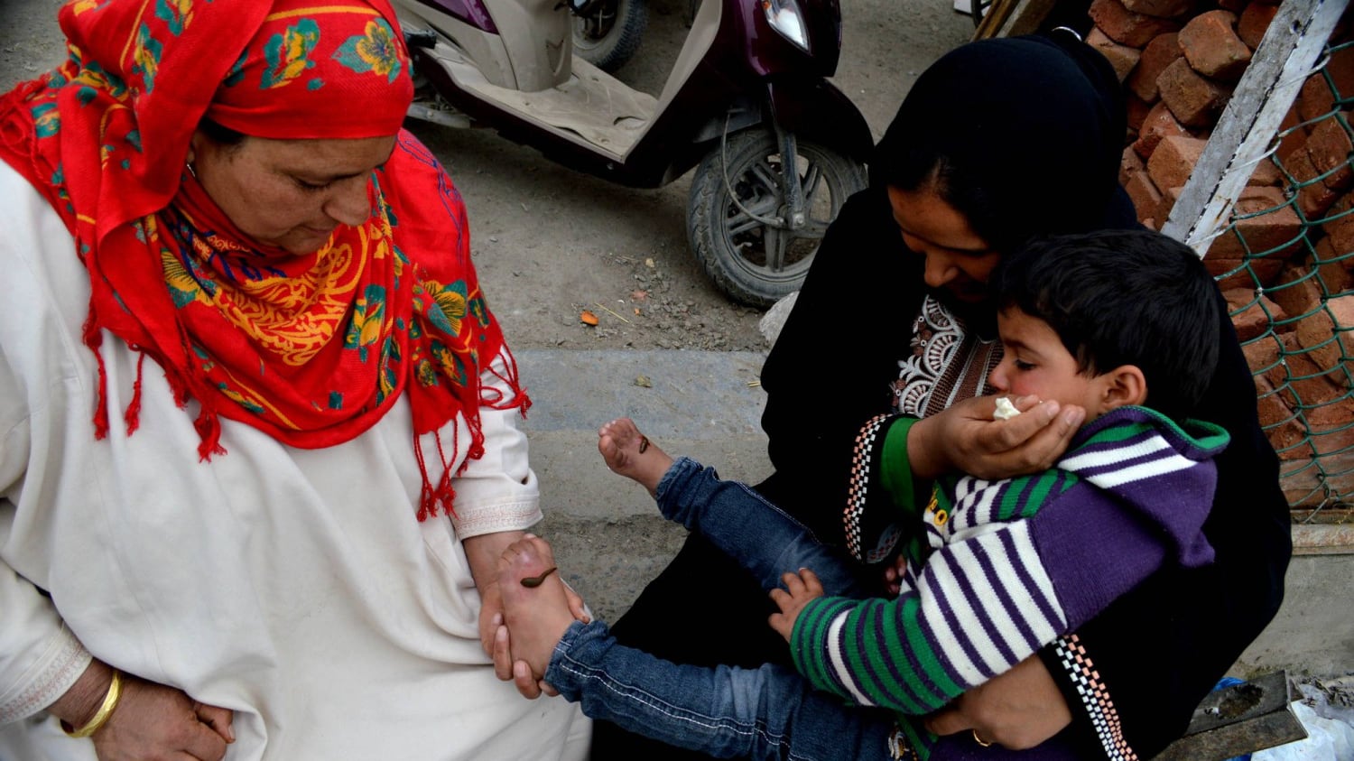 La cura choc del Kashmir: quei guaritori tradizionali che usano le sanguisughe