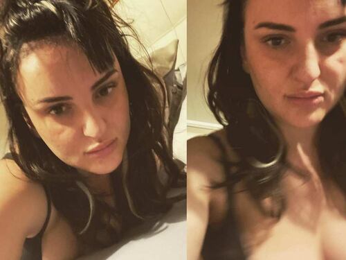 Arisa mostra il seno sui social: "Da piccola era un problema. Ora no"