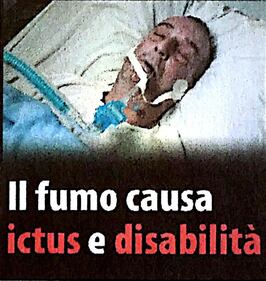 Le "immagini choc" sui pacchetti di sigarette 12