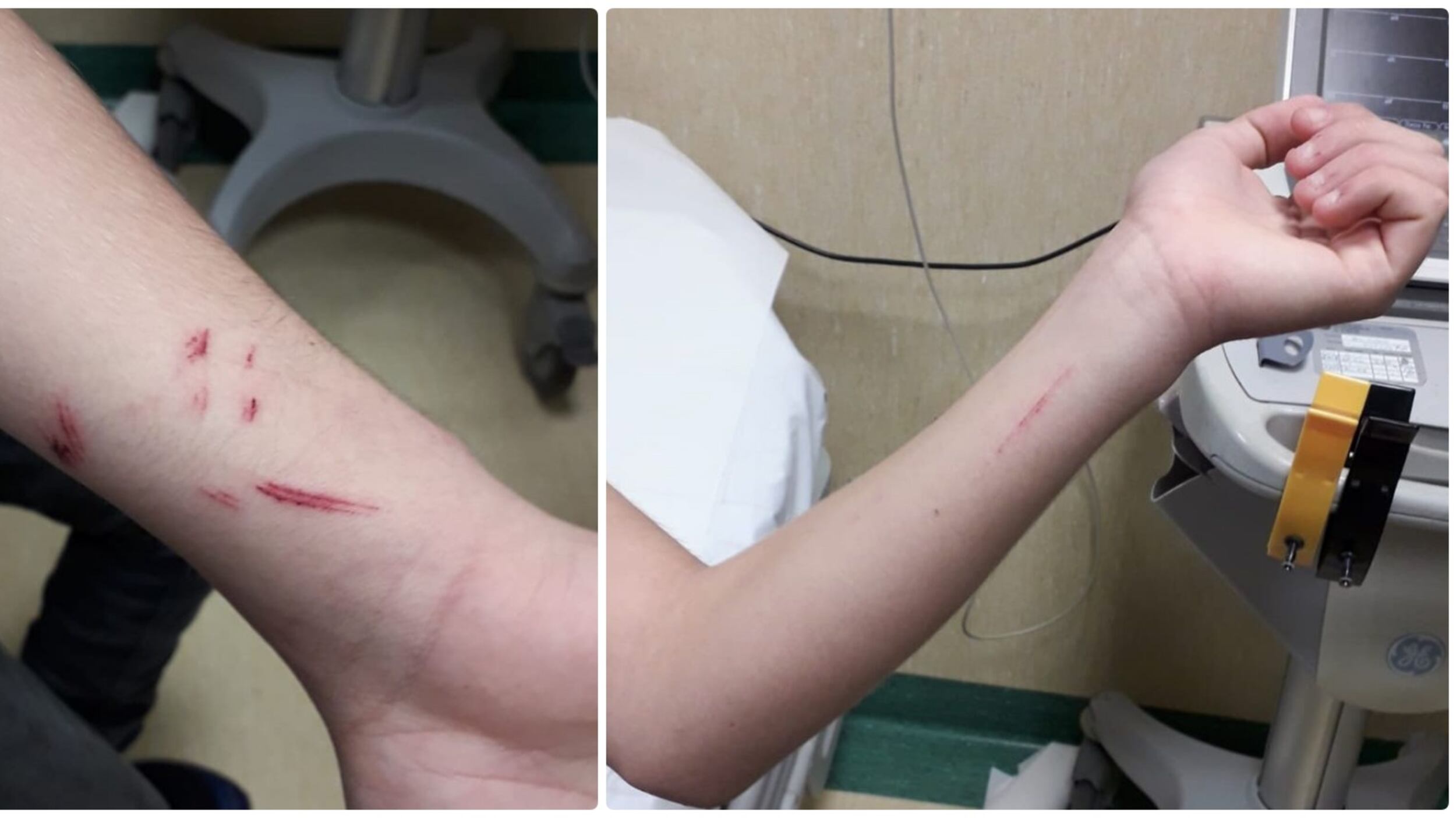 "Mi hanno ferito con una lametta": studente 14enne inventa aggressione