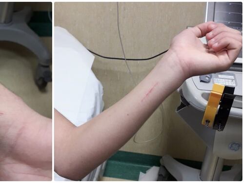 "Mi hanno ferito con una lametta": studente 14enne inventa aggressione