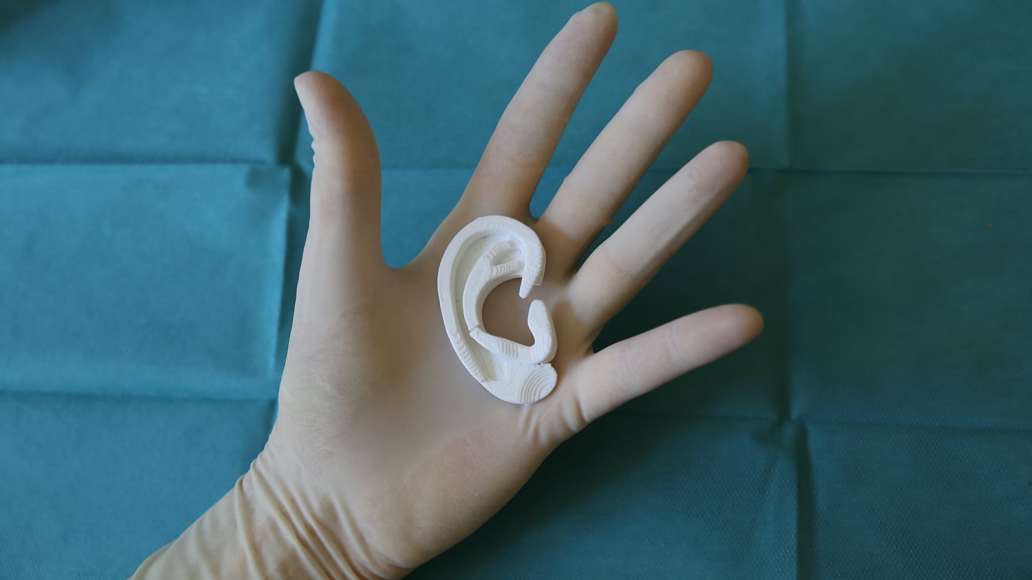 Orecchio bionico da una costola. Il "miracolo" della stampa in 3D