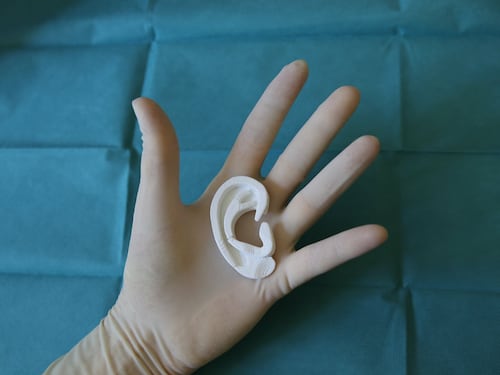 Primo orecchio 3D con cellule umane: ecco lo straordinario intervento