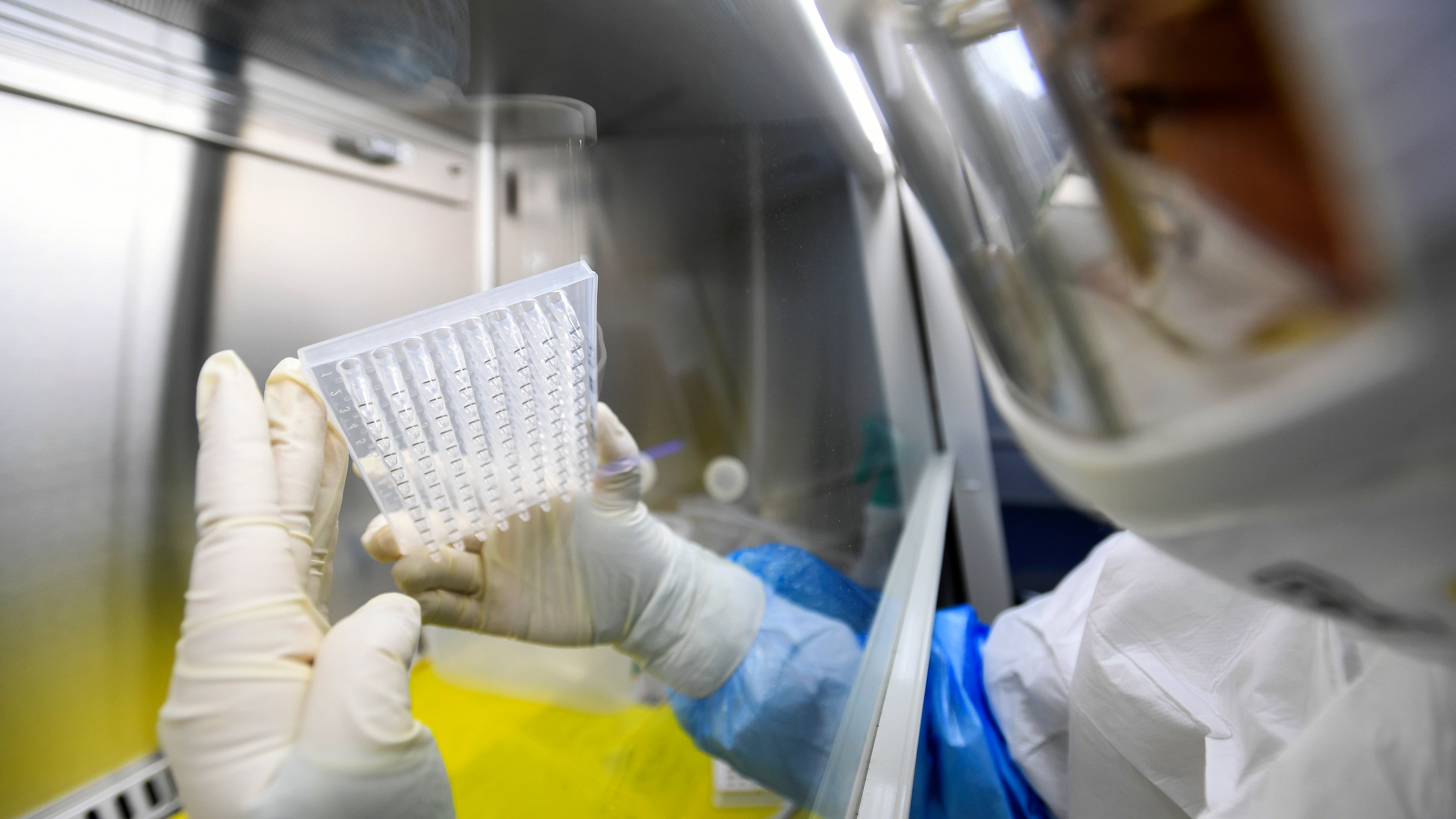 Anziani, malati, uomini: solo loro i più a rischio per il coronavirus