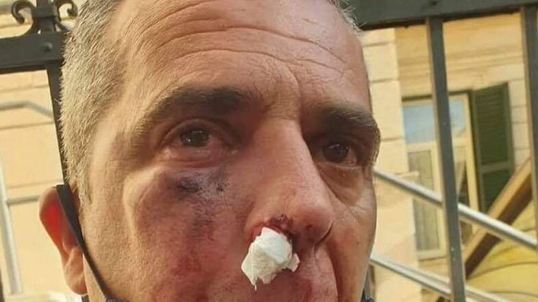 Il migrante che ha spaccato la faccia al militare aveva il reddito di cittadinanza