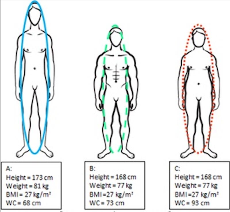 Fonte Obesity