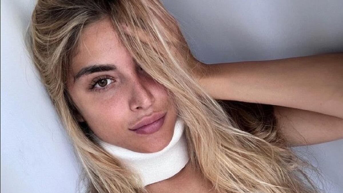 Claudia Motta e Simone Rugiati sono in crisi? Il gossip dopo l'infortunio all'Isola dei Famosi