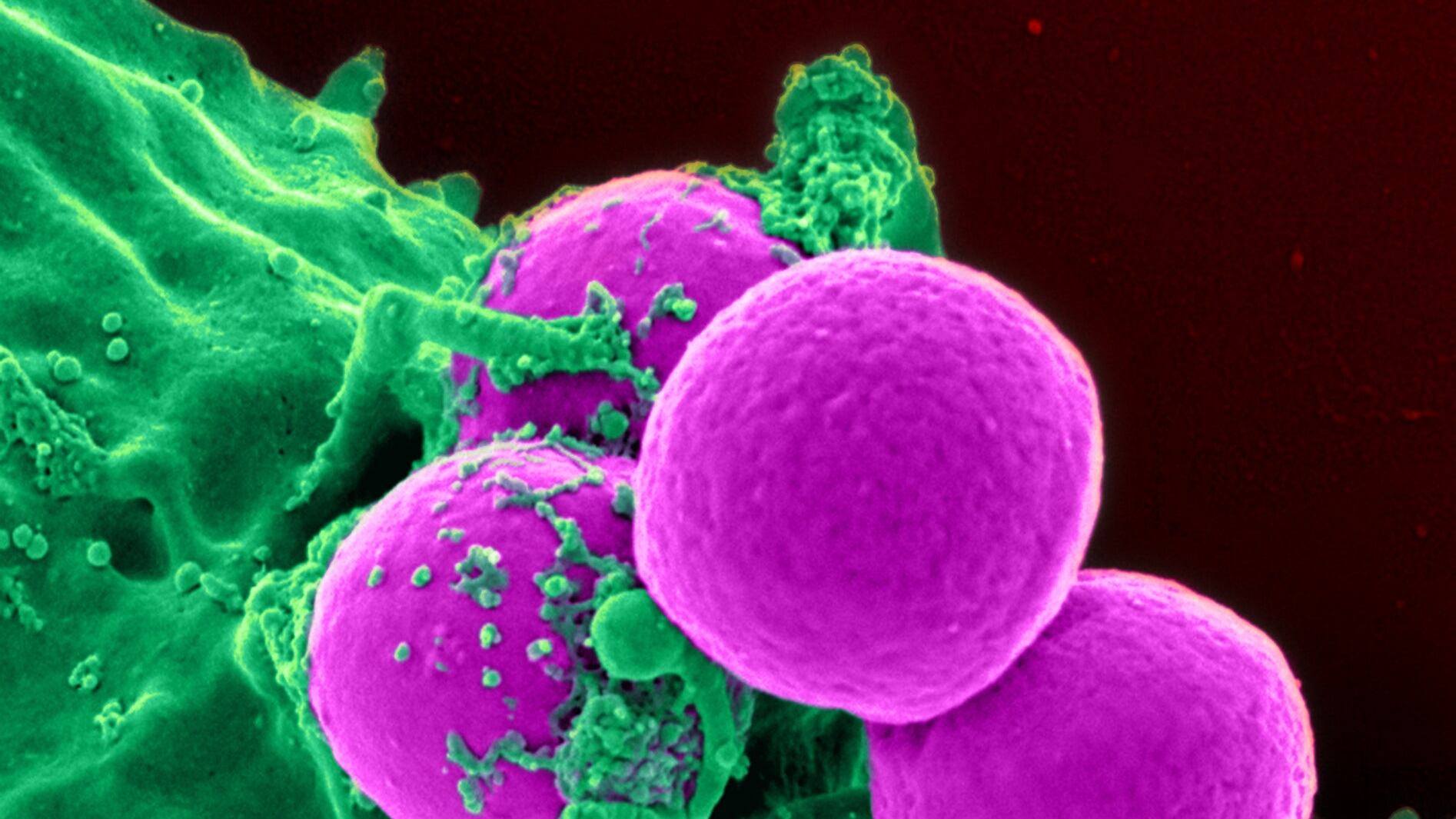 Psicobiotici, ecco i batteri (intestinali) che regolano l'umore