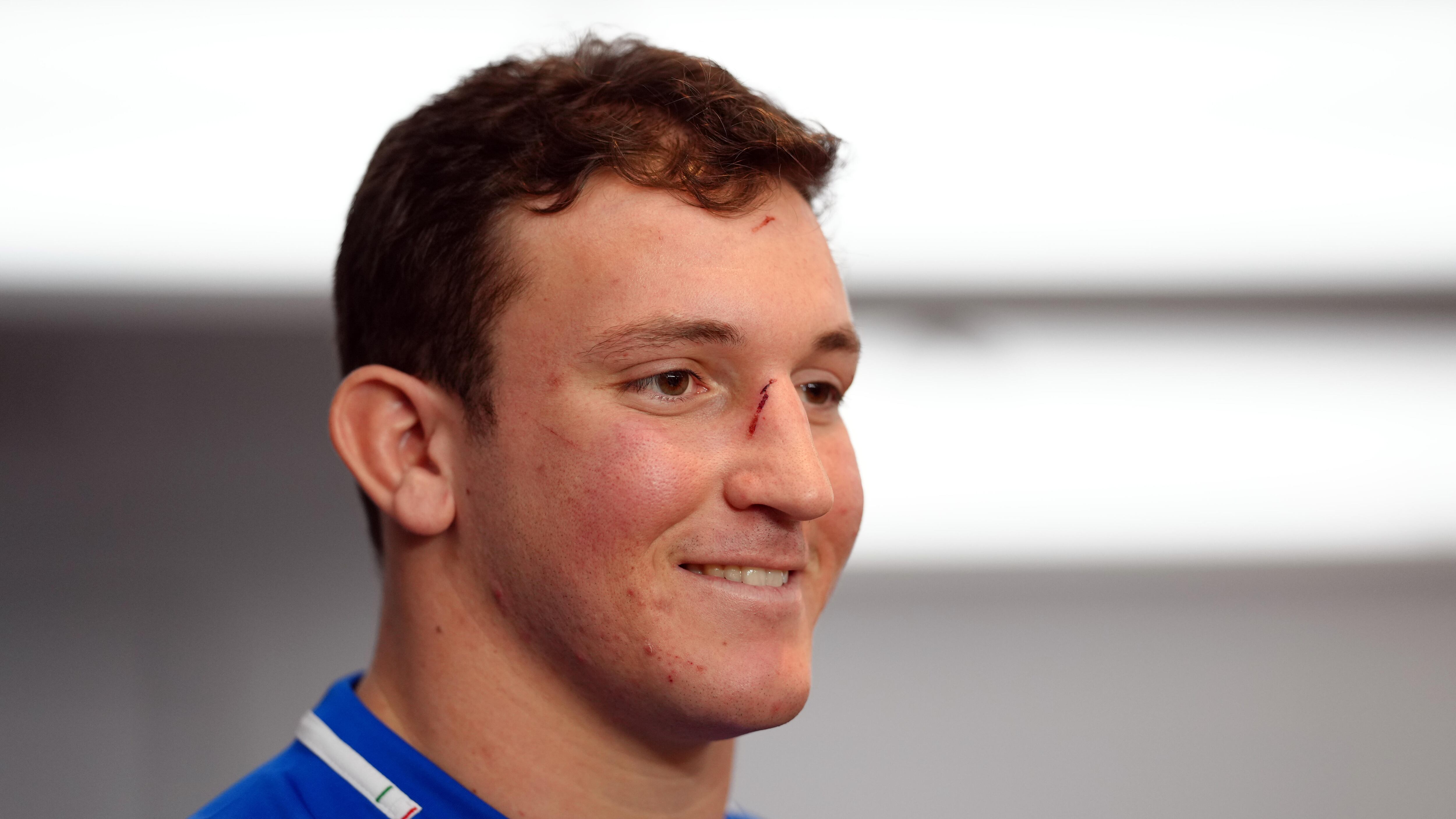 Rugby, Italia battuta. Ma la meta non è lontana