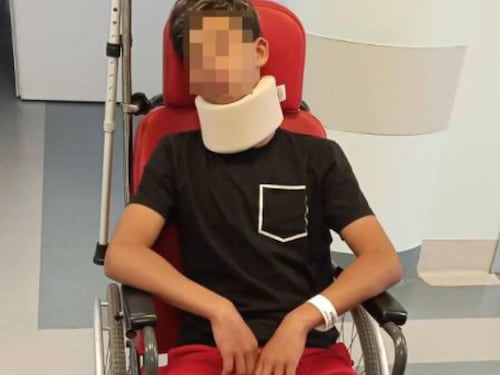 Papà in campo, botte al calciatore: rotti zigomo e malleolo