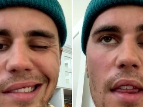 La sindrome di Hunt: ecco cos'è la paralisi di cui soffre Justin Bieber