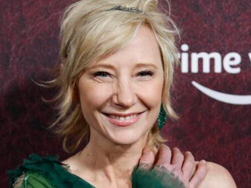 Anna Heche si schianta con l'auto: l'attrice è grave