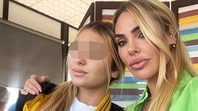 "Avete facce di m...". Chanel Totti si scatena sui ritocchini estetici