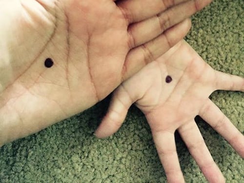 Un neo sulla mano: la campagna contro la violenza sulle donne