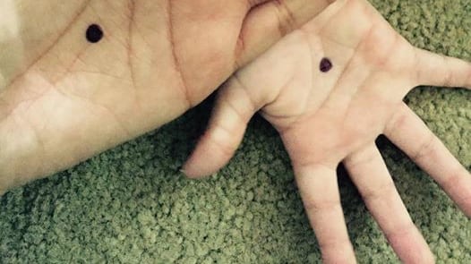 Un neo sulla mano: la campagna contro la violenza sulle donne
