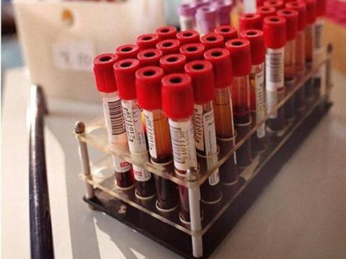 Assenteisti per donare sangue, Avis: "Isolare i furbacchioni"