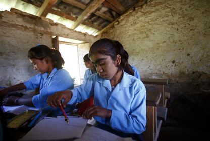 Nepal, soffrono di una malattia che li rende pelosissimi 15