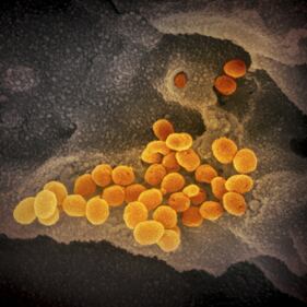 Le nuove immagini del coronavirus 7