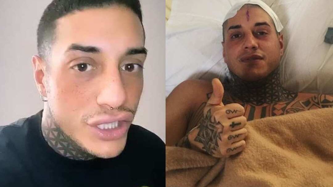 Francesco Chiofalo svela: "Prima di rimuovere il tumore ho pensato di farla finita"