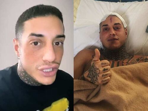Francesco Chiofalo svela: "Prima di rimuovere il tumore ho pensato di farla finita"