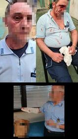 Le foto degli agenti picchiati dai detenuti nelle carceri 2