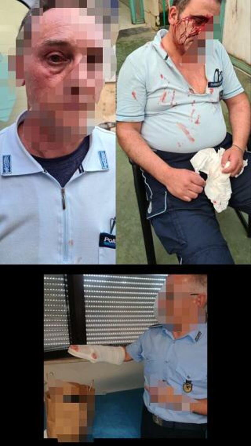 Le foto degli agenti picchiati dai detenuti nelle carceri 2