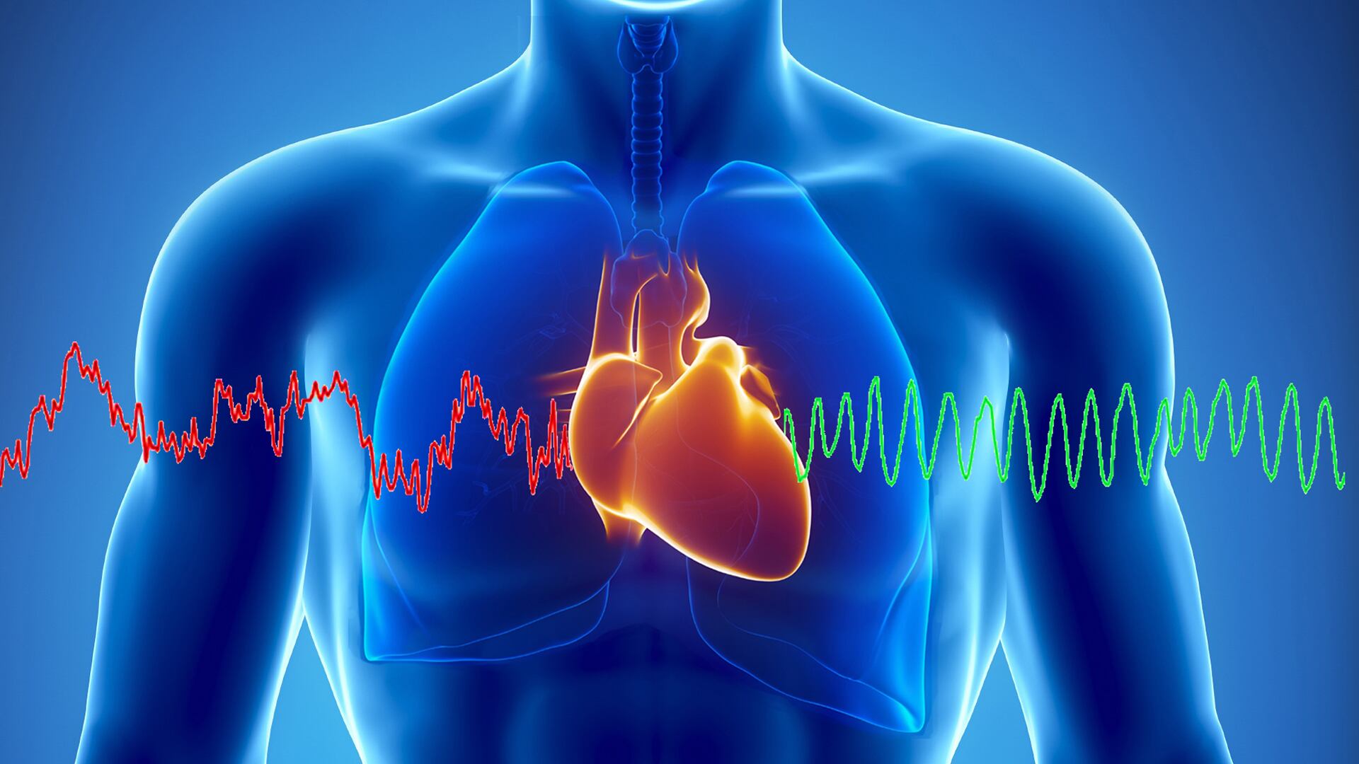 L'allarme sull'infarto "silenzioso" Colpisce e porta a morte prematura