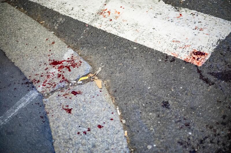 Aggressione a Milano: sei persone ferite, due in modo grave 6