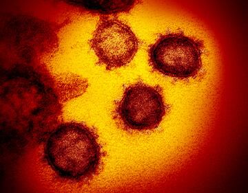Le nuove immagini del coronavirus 6