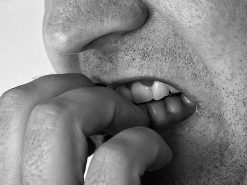 Onicofagia, un disturbo sottostimato di cui esistono forme molto gravi: conseguenze e soluzioni