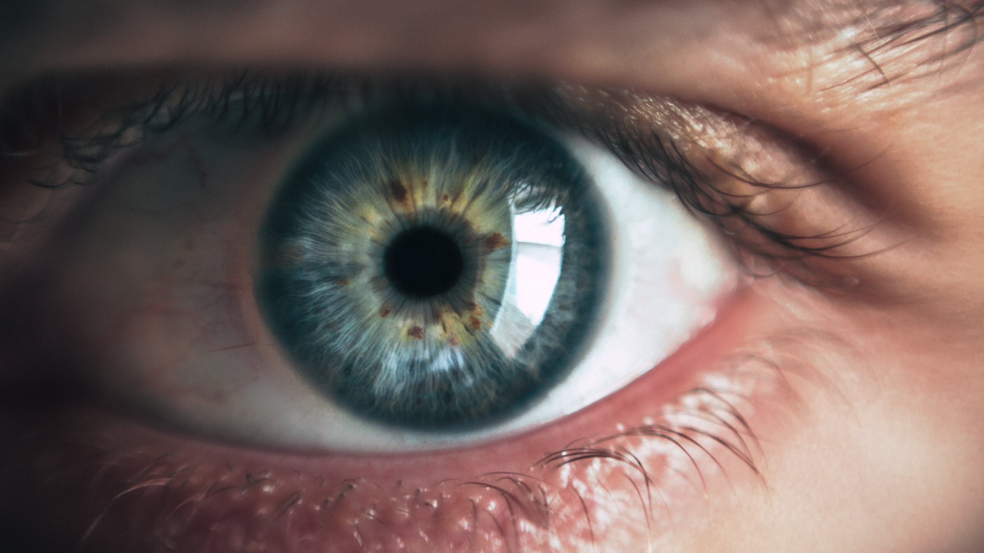 Come i nostri occhi rivelano il rischio di infarto e ictus