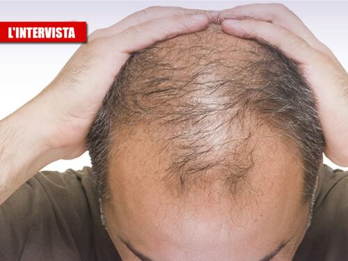 Il virus e il legame coi capelli: "Colpisce di più chi non li ha"