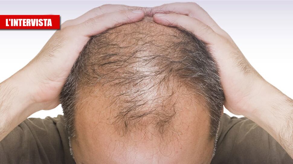 Il virus e il legame coi capelli: "Colpisce di più chi non li ha"