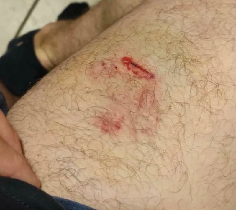 Aggressione pitbull 2