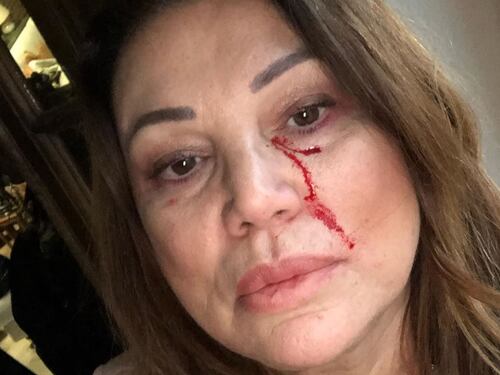 Serena Grandi sui social col sangue sul viso, fan preoccupati ma l'attrice rassicura