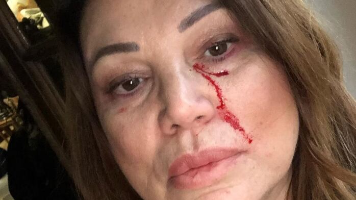 Serena Grandi sui social col sangue sul viso, fan preoccupati ma l'attrice rassicura
