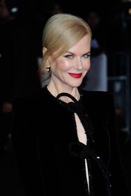 Anche Nicole Kidman con lo spacco inguinale 33