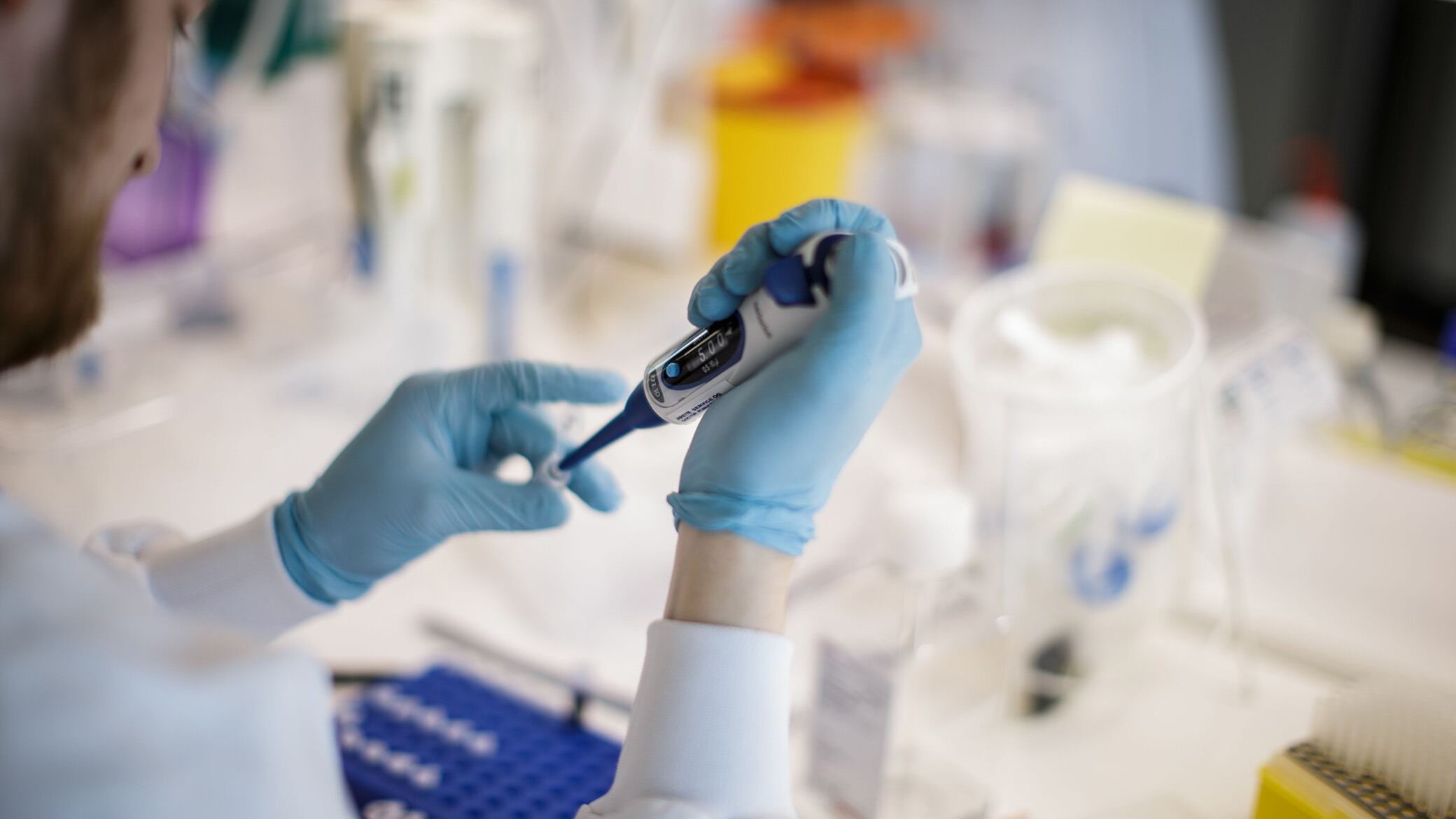 Coronavirus, sono 352 i decessi del giorno. Più di 28mila i nuovi casi
