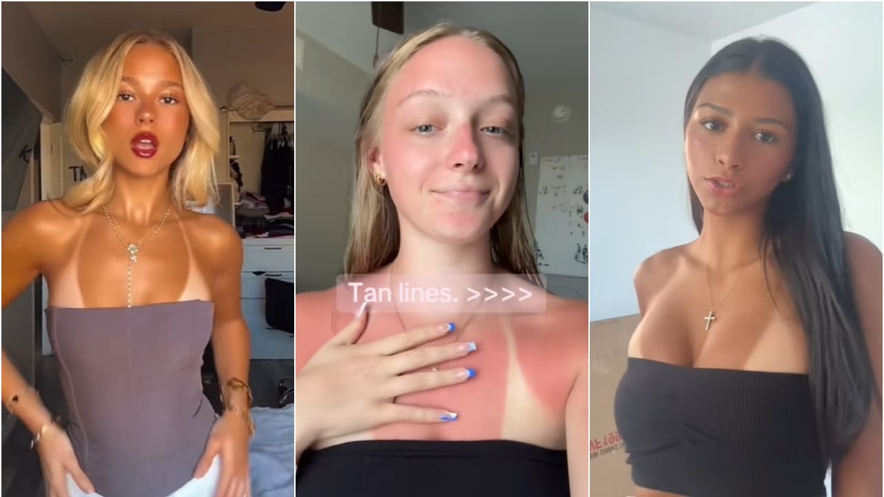Attenti a questo trend: la "Sunburn challenge", l'ultima folle sfida dei social che può costare cara alla pelle